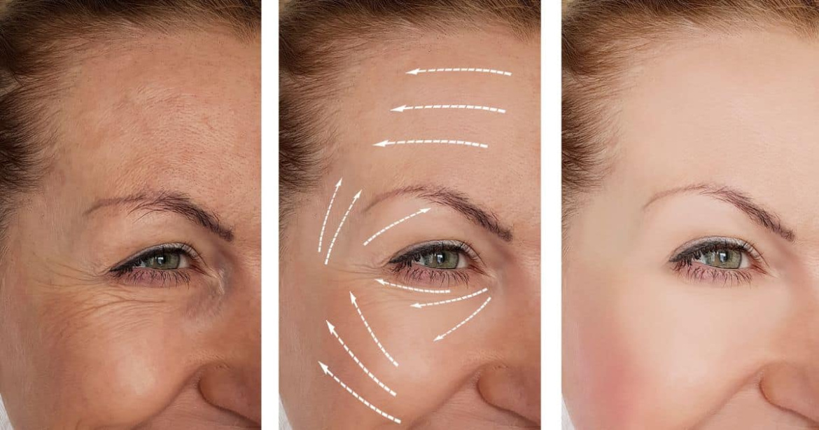 anti_aging_cream.jpg