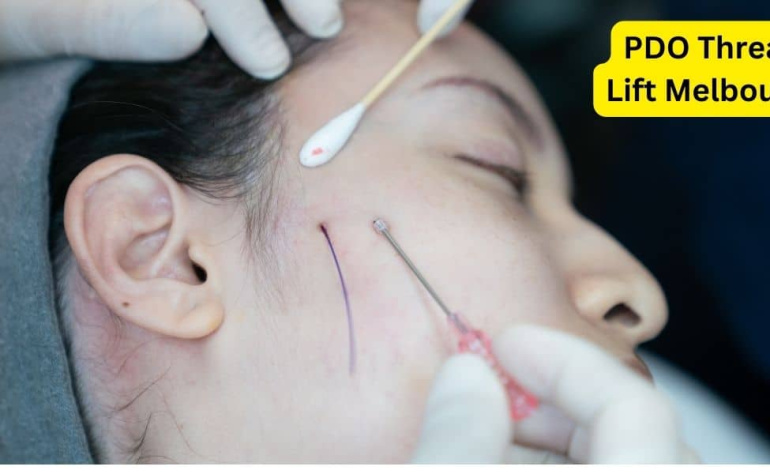 PDO Thread Lift – The Quick and Easy Way to Achieve a Perfect Jawline in Melbourne
